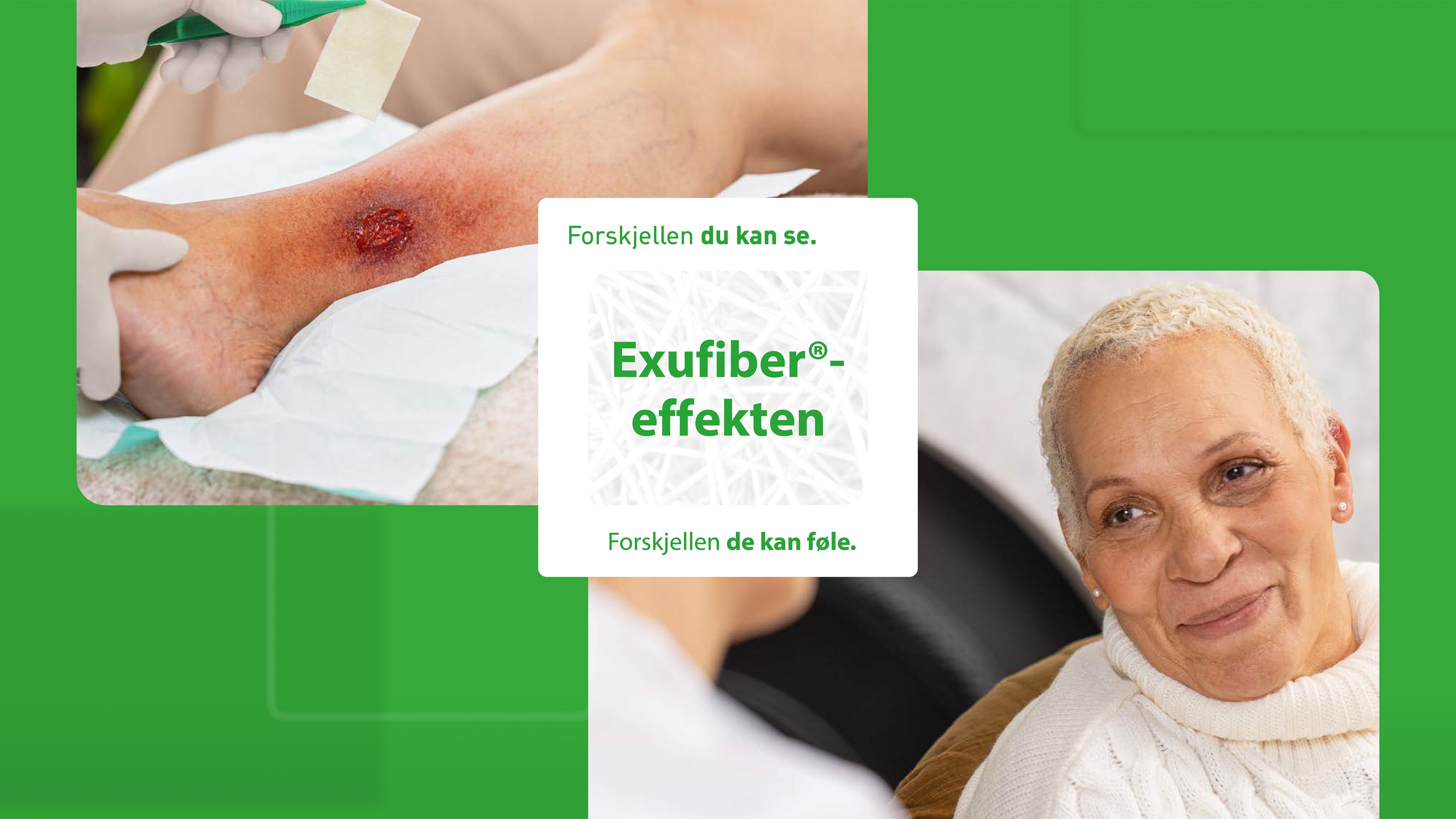 Exufiber-effekten