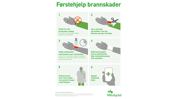 Burns first aid infographic